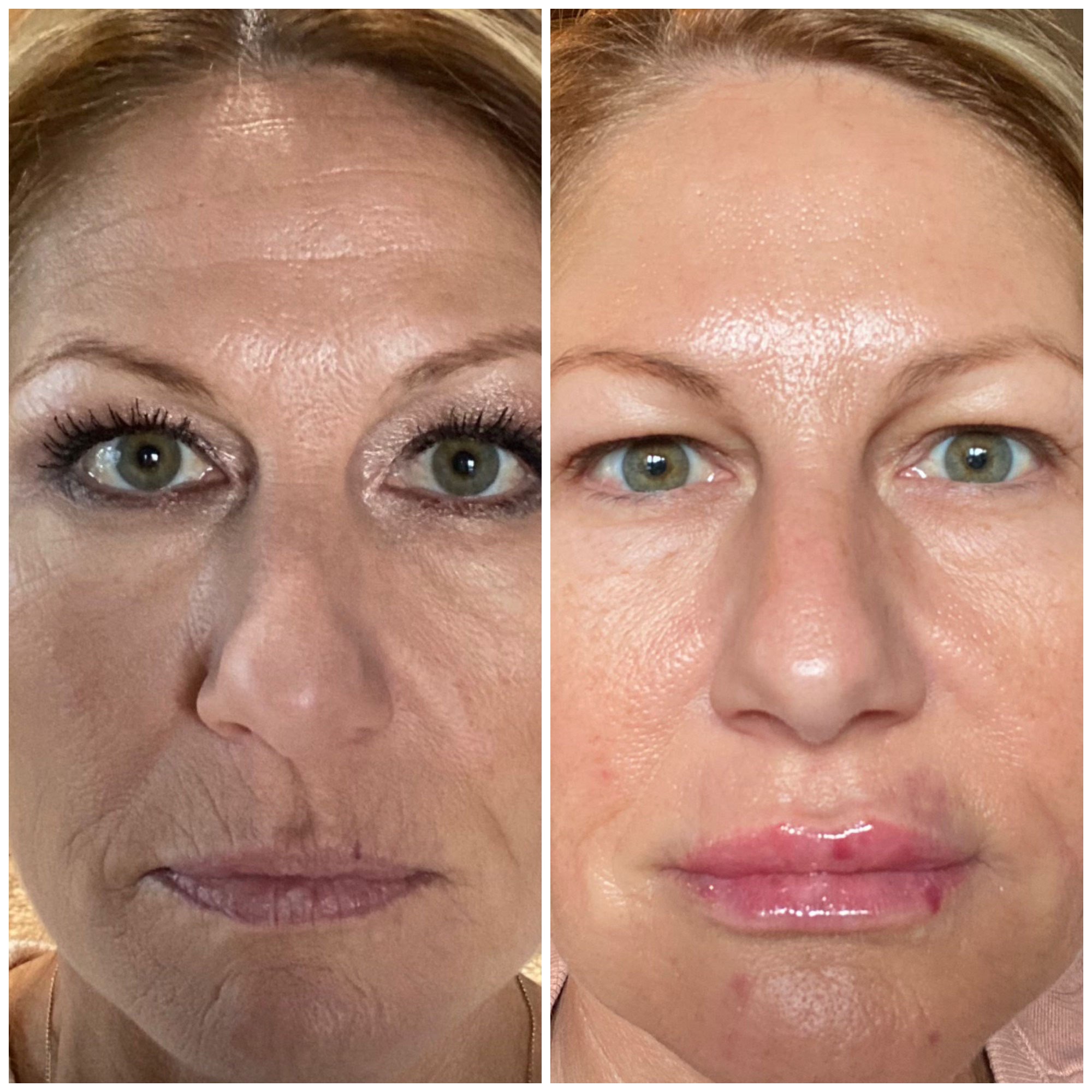 Premier-Medicine-BA-5 Premier Medicine BA